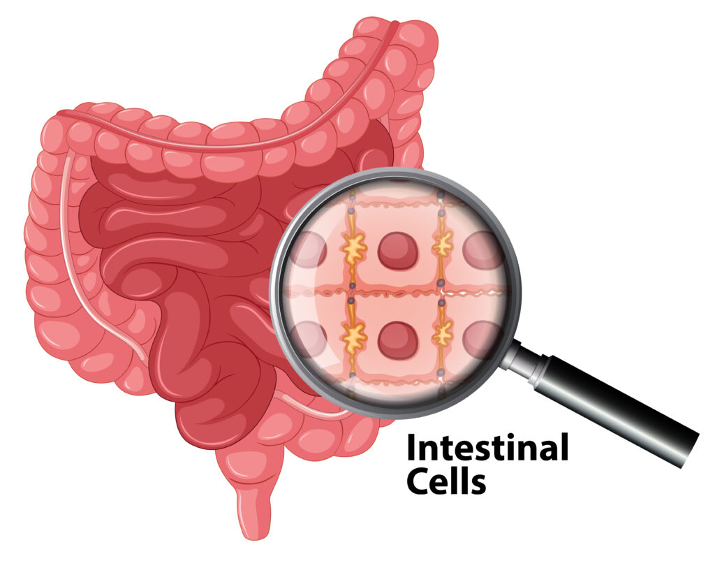 colorectal cancer