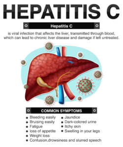 hepatitis C