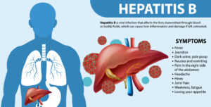 hepatitis B